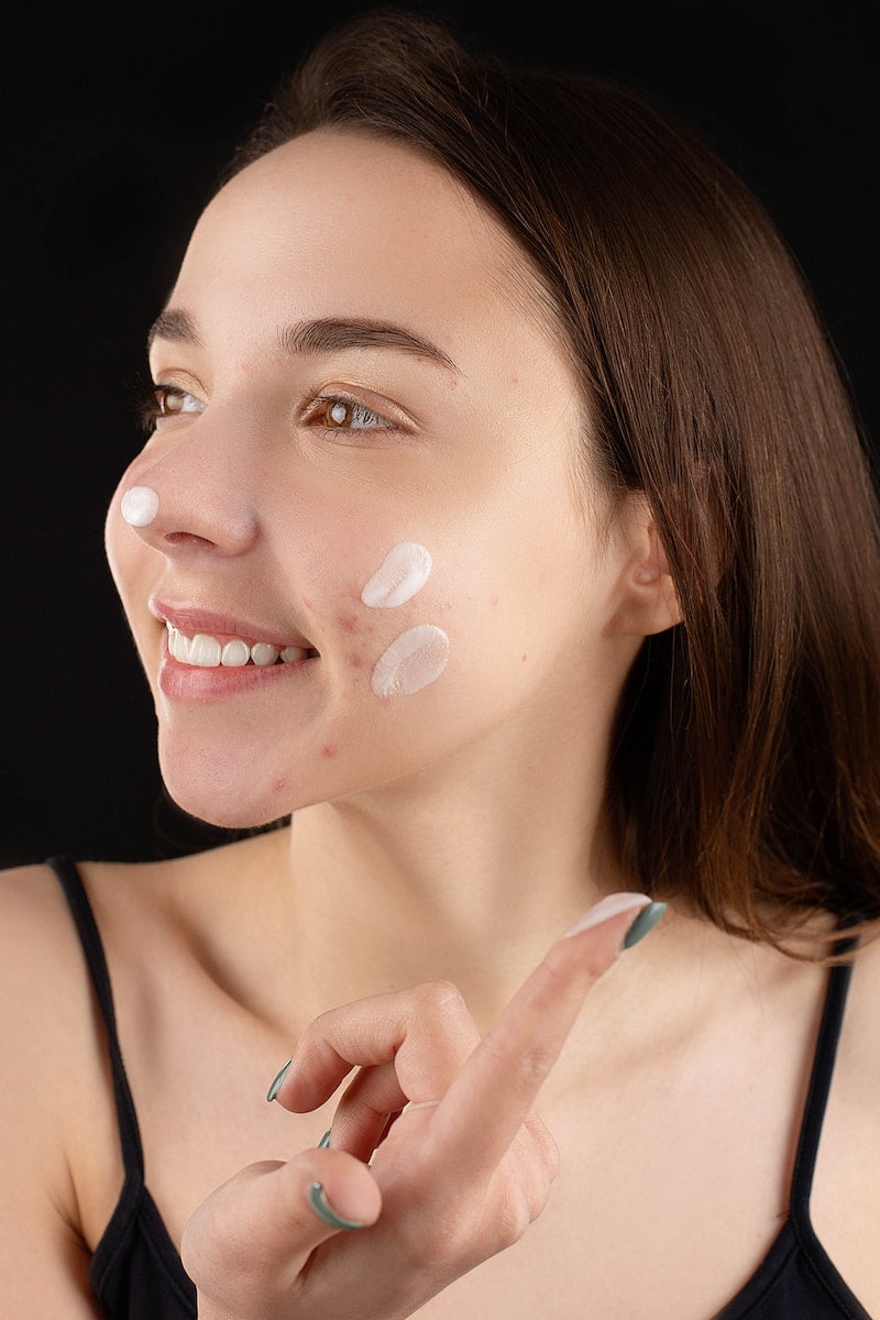 Yosun Peeling ile Doku Kaybı Tedavisi
