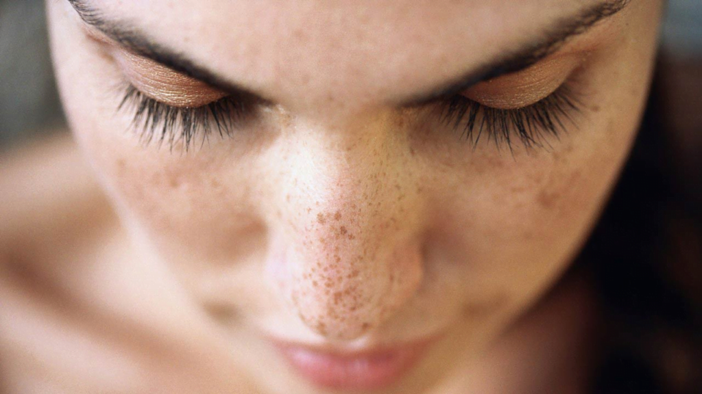Lekesiz Bir Yüz İçin Ne Yapmalı? Yosun Peeling Cilt Lekelerini Gidermede Ne Kadar Etkili?