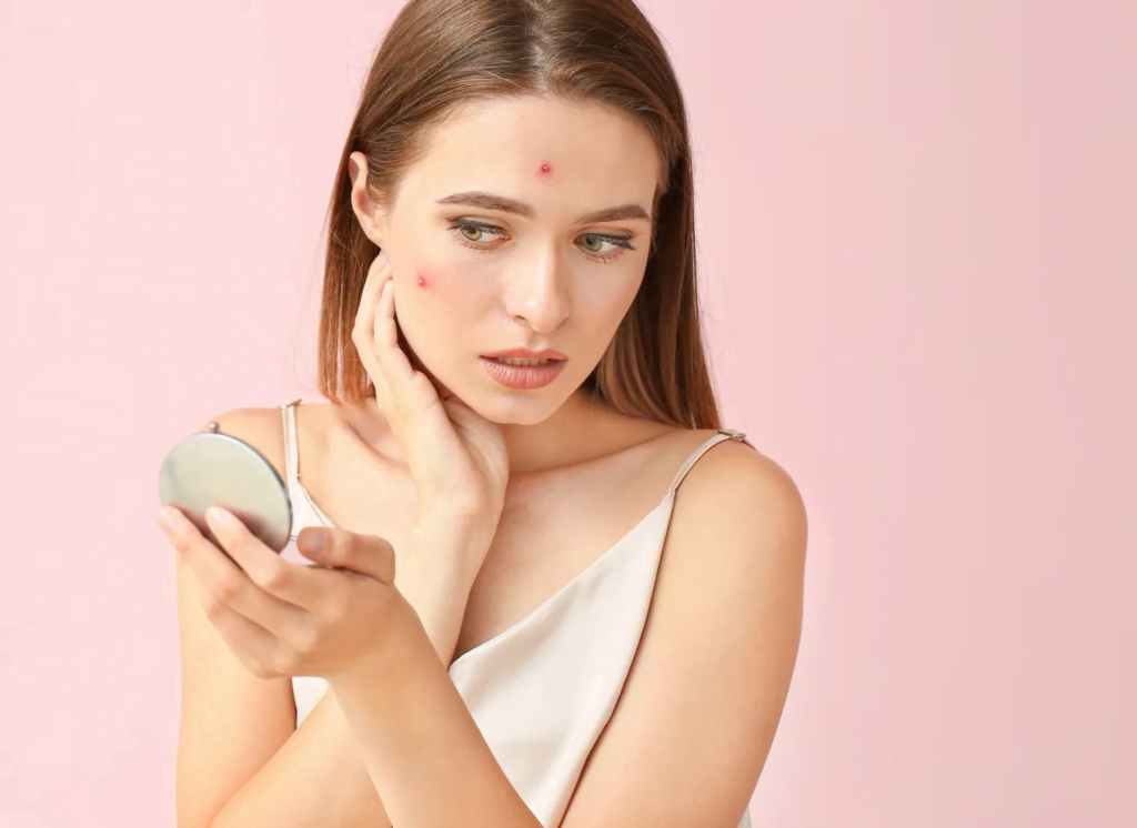 Sivilce Karşıtı Peeling Seçimi? Neden Regnee Yosun Peeling?
