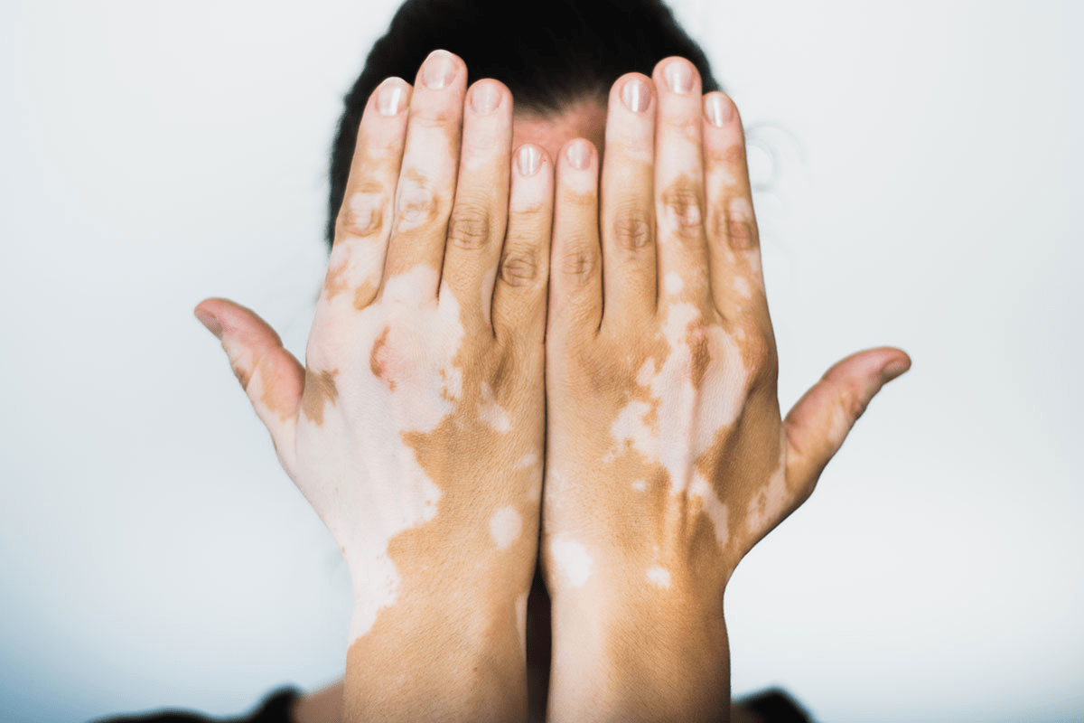 Yosun Peeling ve Cilt Pigmentasyon Sorunları: Denizin Derinliklerinden Gelen Çözüm 1