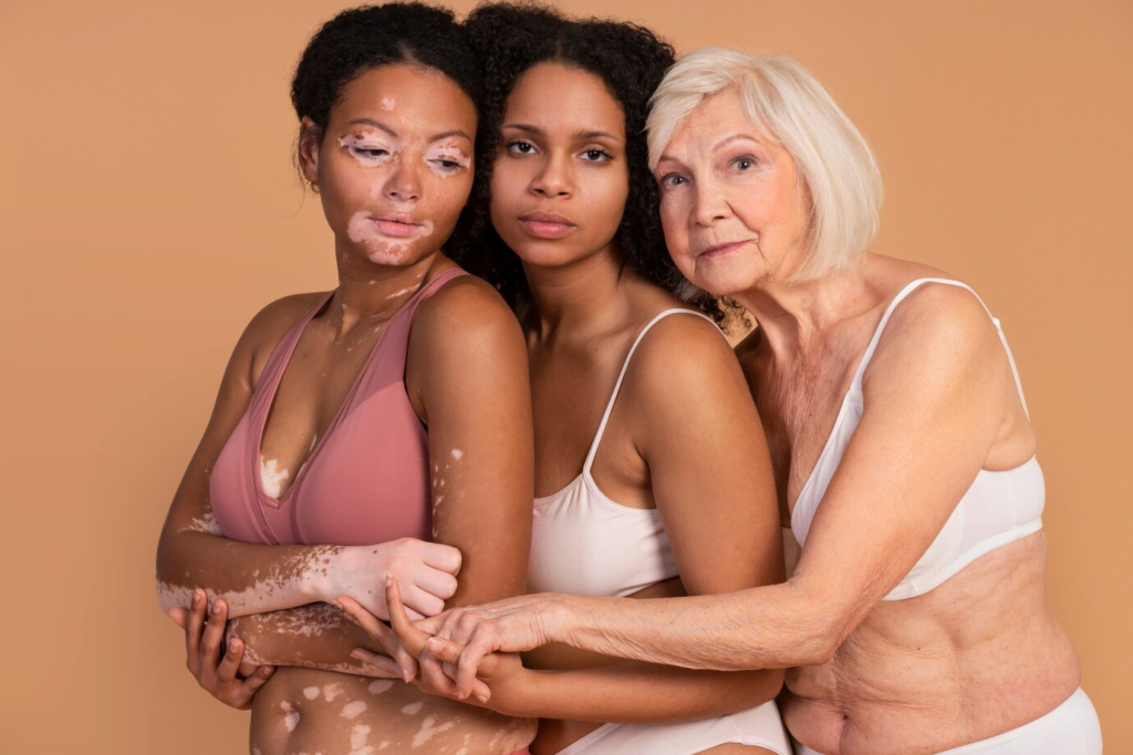 Yosun Peeling Leke Tedavisi: Cildinizdeki Lekelere Veda Edin