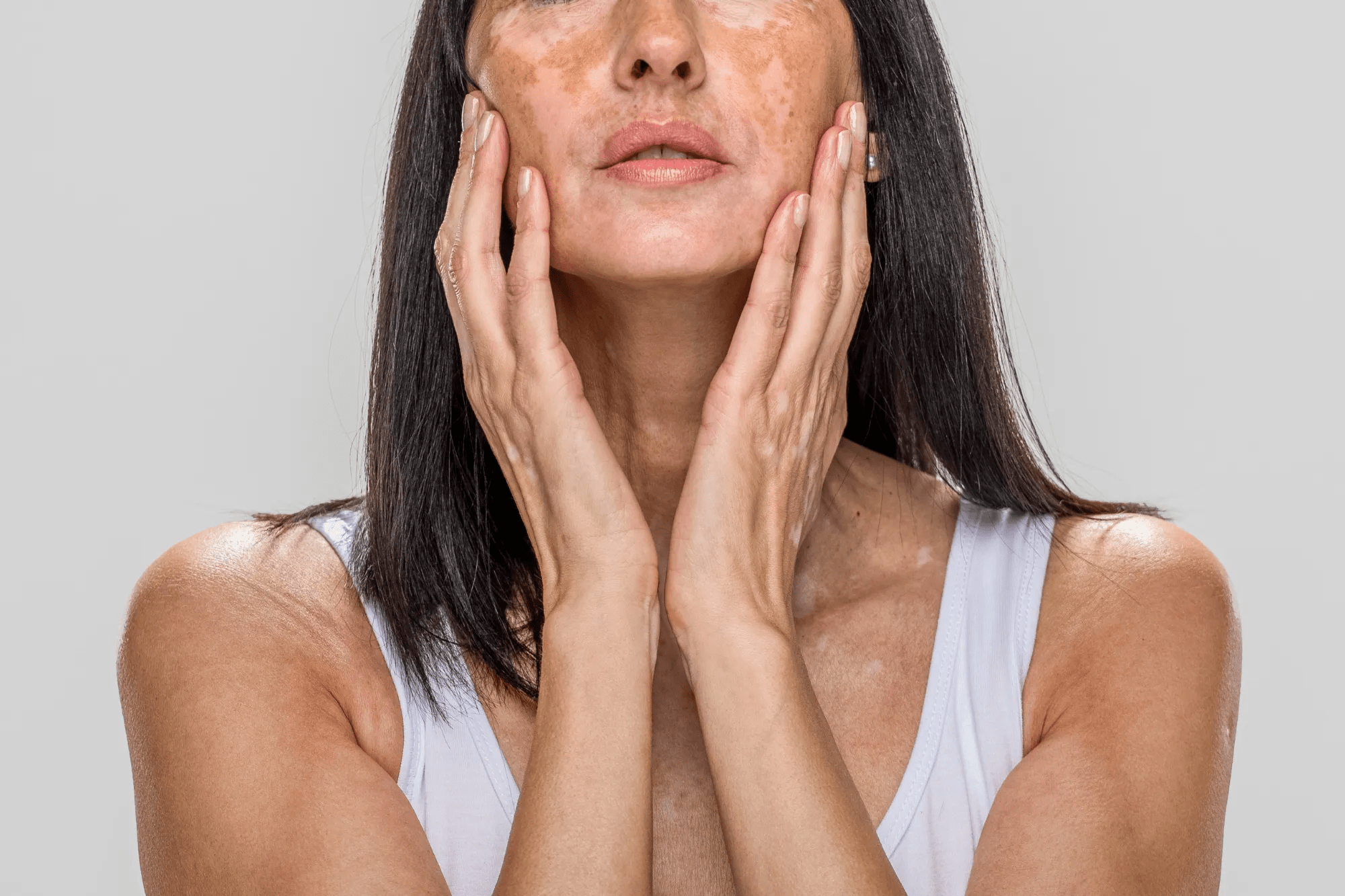 Yosun Peeling: Cilt Tonu Eşitsizliğine Doğal Bir Çözüm mü?