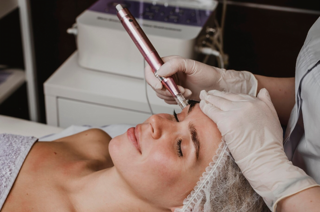 Yüz Peelingi ve Mikrodermabrazyon: Farklılıklar ve Hangisi Sizin İçin Daha İyi? 2
