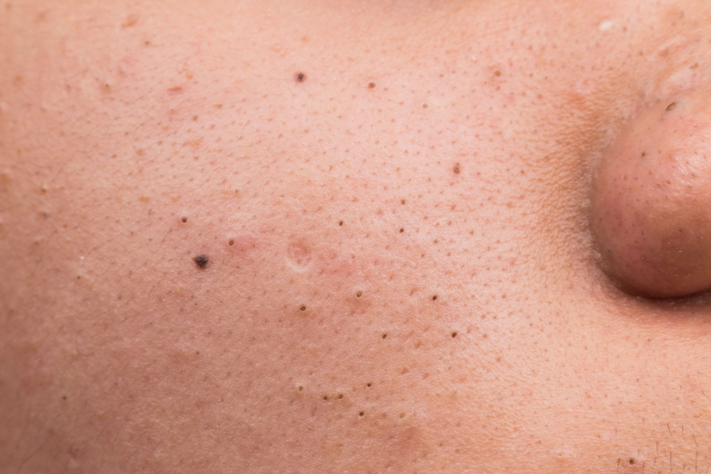 Siyah Noktalara Son! Yosun Peeling ile Cildinizi Arındırın ve Pürüzsüzleştirin 1
