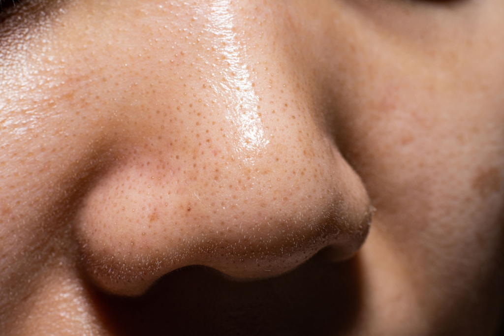 Siyah Noktalara Son! Yosun Peeling ile Cildinizi Arındırın ve Pürüzsüzleştirin