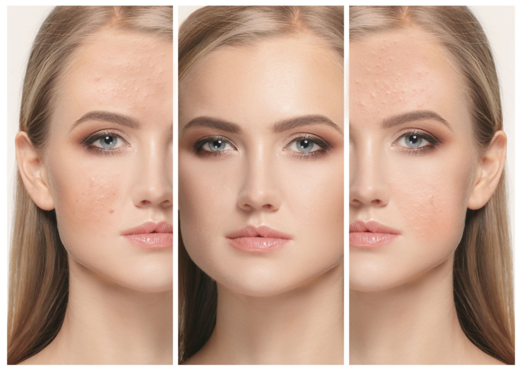 Algae Yosun Peeling Hakkında Merak Edilen Sorular