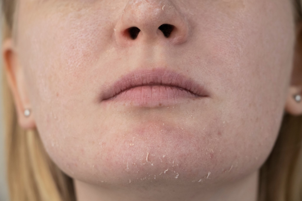 Cilt Problemlerine Çözüm: Skin Streaming Cilt Bakımı Trendi ile Doğru Teşhis ve Tedavi 3