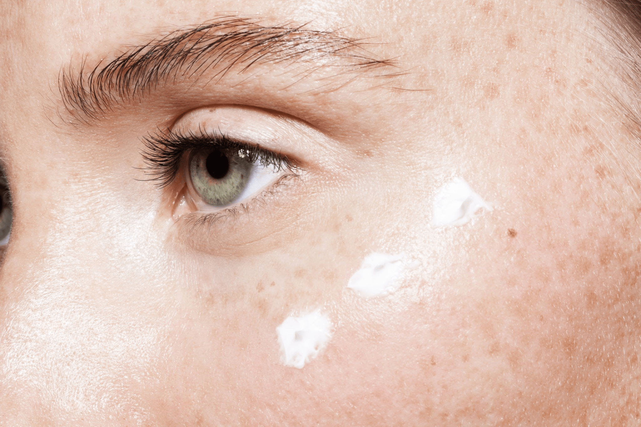 Cilt Problemlerine Çözüm: Skin Streaming Cilt Bakımı Trendi ile Doğru Teşhis ve Tedavi