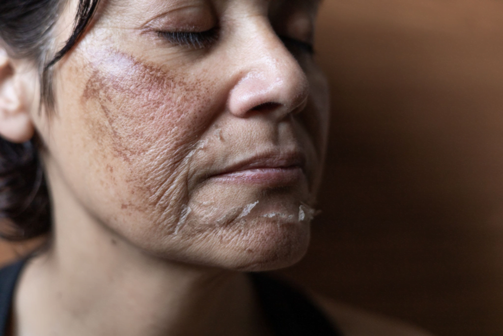 Yosun Peeling Kırışıklığa İyi Gelir Mi? Doğal Cilt Gençleştirici Yöntemler 5