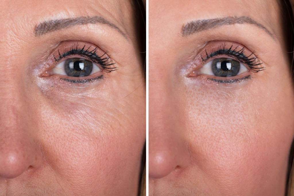 Retinoidler Nedir Ne İşe Yarar? Cildiniz İçin Bir Devrim! 2