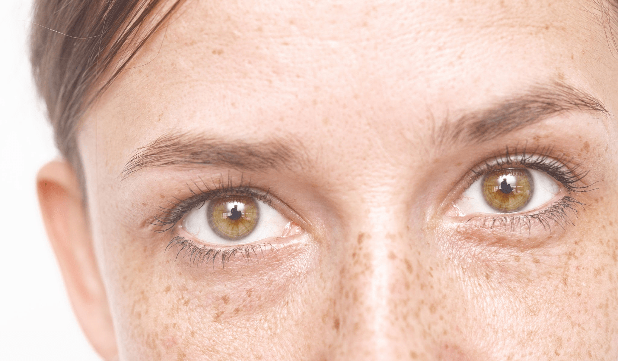 Ciltteki Lekelenmeler İçin Yosun Peeling: Doğal Bir Çözüm Mü? 1