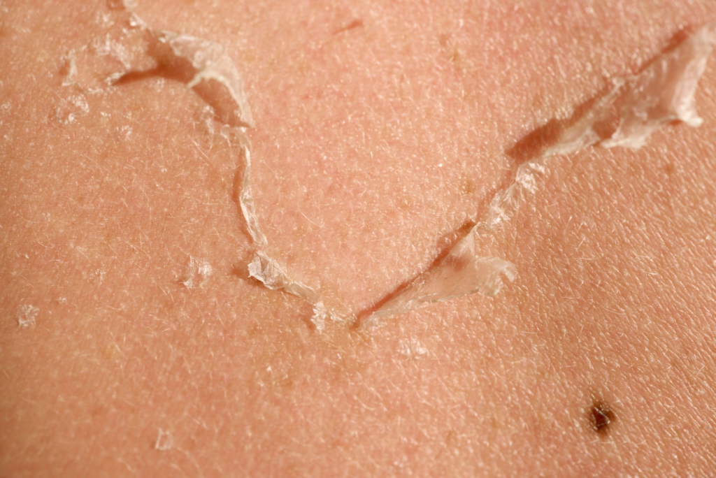 Glass Skin: Body Perfect Yosun Peeling ile Ayna Gibi Parlayan Bir Cilt İçin Gizli Sırrınız 3