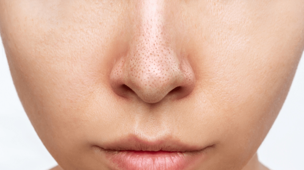 Retinol Komedonlara İyi Gelir Mi?